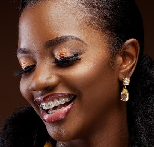 Dental Braces at Cimbak Dental Clinic Port Harcourt